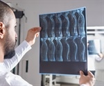 Metagenomic sequencing helps examine differences in the gut microbiome after injury