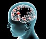 Study identifies DNA alterations that underpin brain and cognitive decline in the elderly