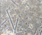 New technique boosts the efficacy of future malaria vaccines