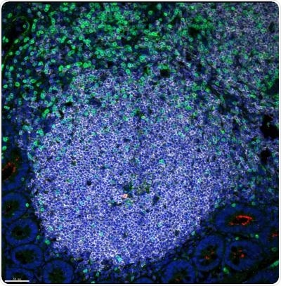 Study may help develop multi-pronged HIV eradication strategies