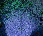 Study may help develop multi-pronged HIV eradication strategies
