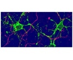 New types of glial cells in the brain may treat neurodegenerative diseases