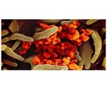 A new treatment approach against SARS-CoV-2