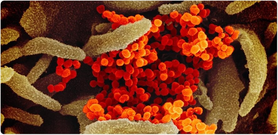 A new treatment approach against SARS-CoV-2