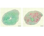 Single mutation leads to rare genetic muscle disease
