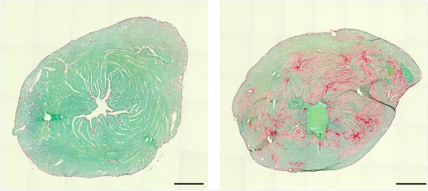 Single mutation leads to rare genetic muscle disease