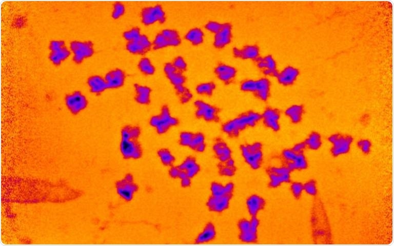 Study reveals the mass of human chromosomes measured using X-rays for the first time