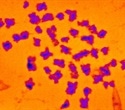 Study measures the mass of human chromosomes using X-rays for the first time