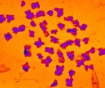 Study measures the mass of human chromosomes using X-rays for the first time