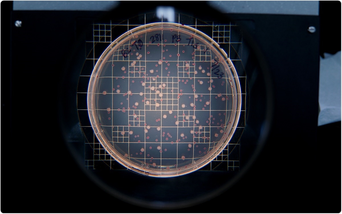 Pre-trained viruses are more effective in countering antibiotic resistance