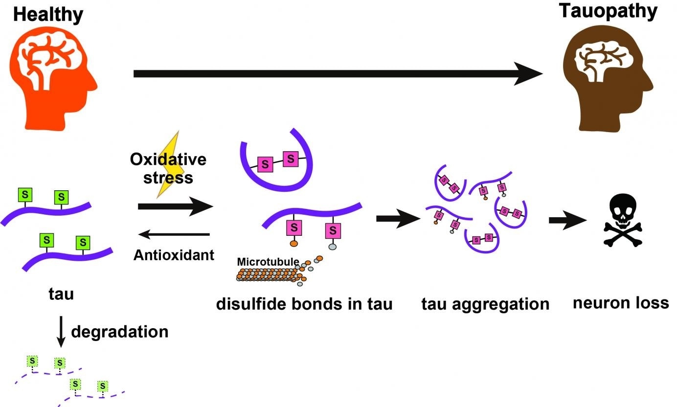 Specific chemical feature of a key protein may lead to neurodegenerative diseases