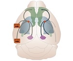 Misfolded tau proteins cause progressive degeneration in Alzheimer's disease