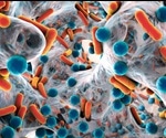 Role of Biotechnology in the Fight Against Antibiotic Resistance