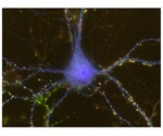 Study shows astrocytes induce sex differences during brain development