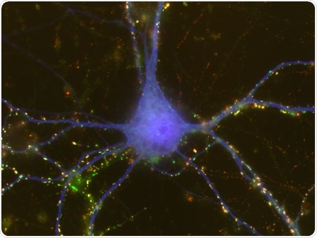 Study shows astrocytes induce sex differences during brain development