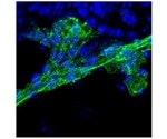 Universal stem cells exhibit the potential for more cost-effective cell therapy