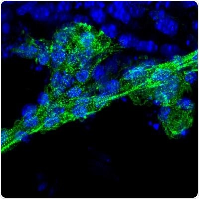 Universal stem cells exhibit the potential for more cost-effective cell therapy