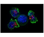 New study could prevent T cell exhaustion in the immune system’s fight against cancer