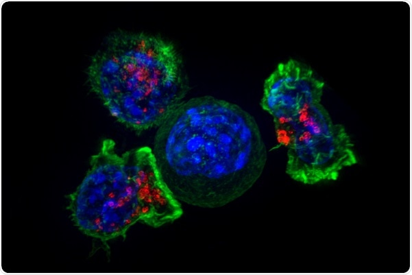 New study could prevent T cell exhaustion in the immune system’s fight against cancer