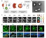 New formulation to administer antibodies for choroidal neovascularization therapy