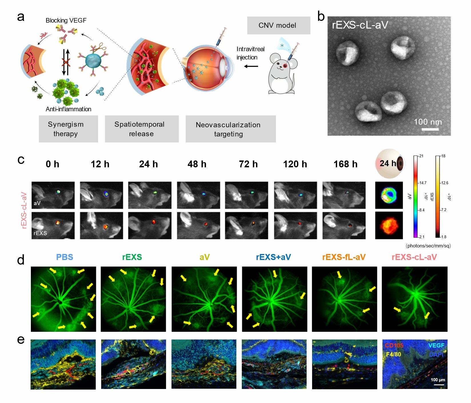 New formulation to administer antibodies for choroidal neovascularization therapy