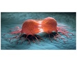 World’s first cancer cell model helps modern cancer research and drug development