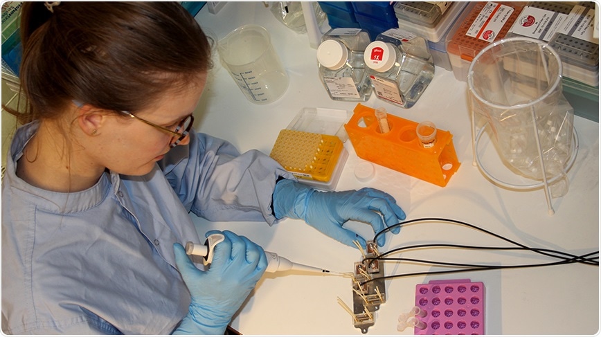 Experimental model reveals the protective role of antioxidants in neurodegenerative disorders