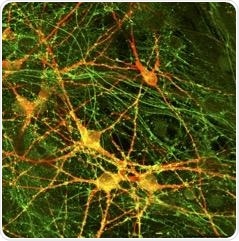 Study reveals neurotransmitter release impairments in schizophrenia patients