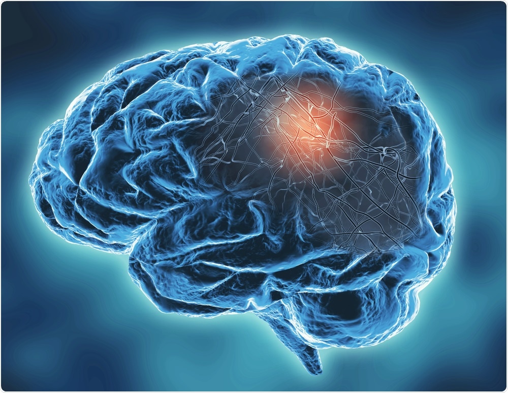 Neurodegenerative disease Neurodegenerative disease
