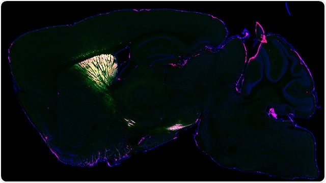 Scientists develop new tool to identify neuronal proteins in animal models