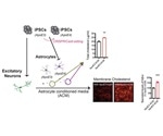 Brain cholesterol promotes toxic amyloid plaque formation in Alzheimer’s disease