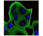 Study explores the effectiveness of a natural protein against colon cancer cells