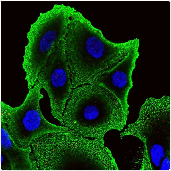 Study explores the effectiveness of a natural protein against colon cancer cells
