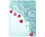 Researchers identify virus-derived variations in human genomes