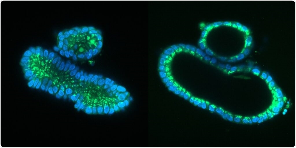 Researchers use prime editing to correct mutations causing cystic fibrosis in organoids