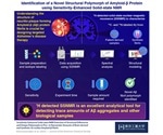 Study deciphers the atomic level structural differences of Amyloid β polymorph