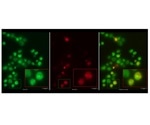 Experts decode the genetic mechanism governing the speed of mRNA translation