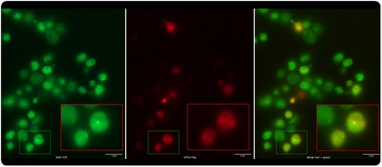 Experts decode the genetic mechanism governing the speed of mRNA translation