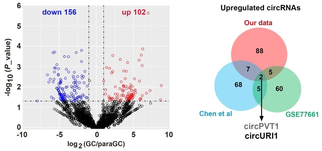 Study finds the link between circular RNA and alternative splicing in gastric cancer