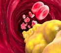 Restoring cholesterol levels could be a new therapeutic approach for neurodegenerative diseases