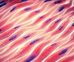 Study uncovers mechanism behind skin cell transformation