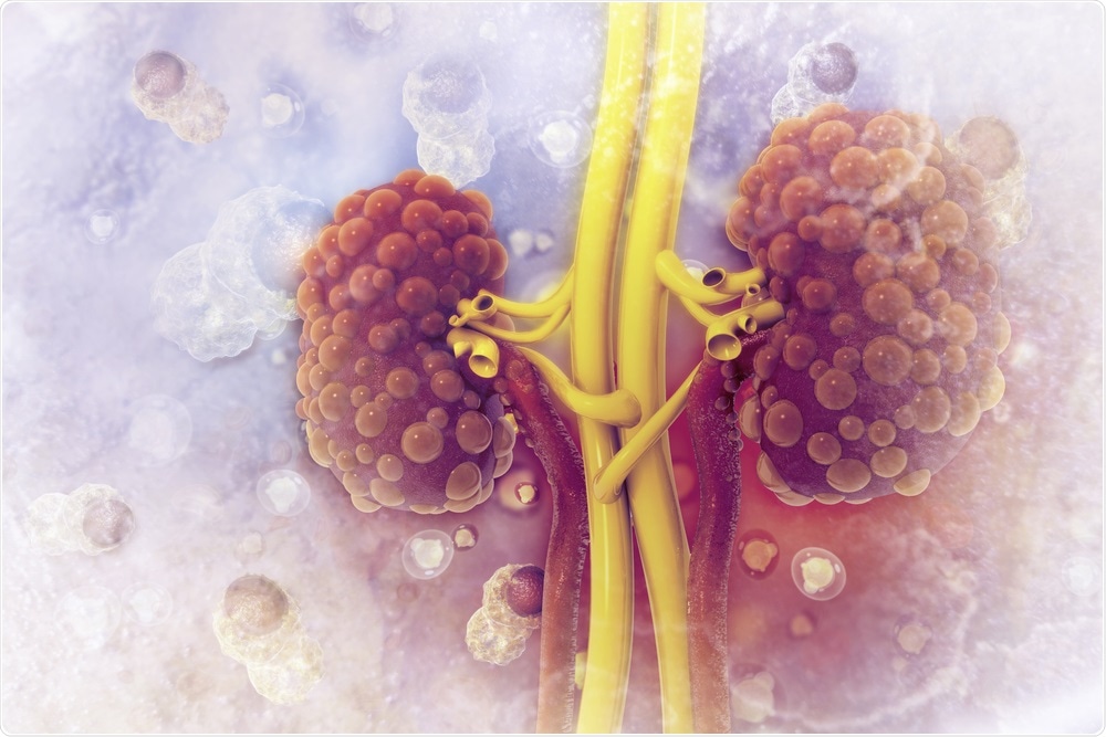 Kidney Disease Kidney Disease