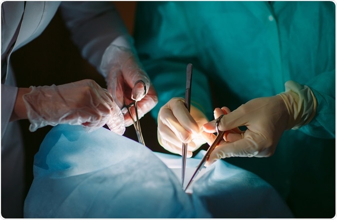 Transplantation