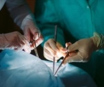 An Overview of Transplant Immunology