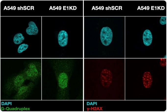 Tumor suppressor protein binding to RNA also binds DNA, says study