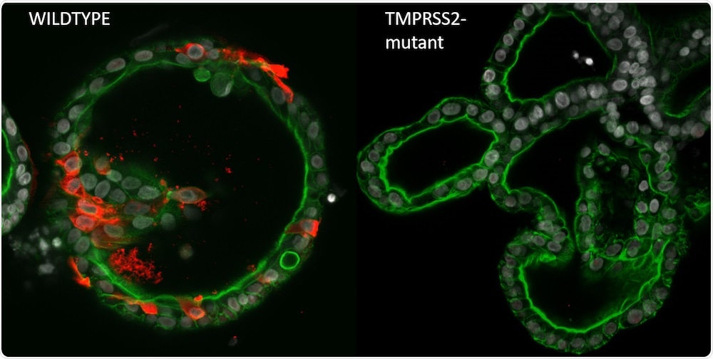 Study outlines the advantages of organoids for basic research into coronaviruses