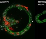 Study outlines the advantages of organoids for basic research into coronaviruses