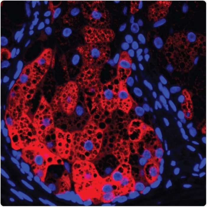 Researchers provide novel treatment target for common skin condition
