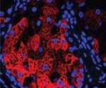 Researchers provide novel treatment target for common skin condition