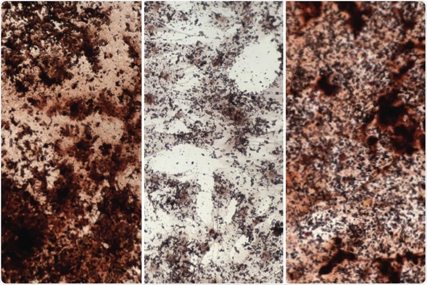 Changes in epigenome responsible for reduced stem cell function upon aging